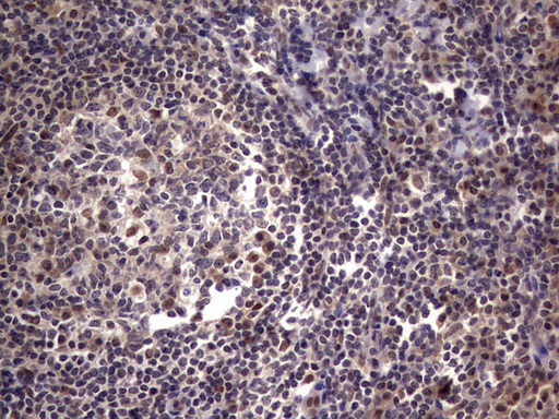 C14orf166 Antibody - IHC of paraffin-embedded Human tonsil using anti-C14orf166 mouse monoclonal antibody. (Heat-induced epitope retrieval by 1 mM EDTA in 10mM Tris, pH8.5, 120°C for 3min).