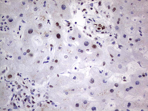 C14orf166 Antibody - IHC of paraffin-embedded Human liver tissue using anti-C14orf166 mouse monoclonal antibody. (Heat-induced epitope retrieval by 1 mM EDTA in 10mM Tris, pH8.5, 120°C for 3min).
