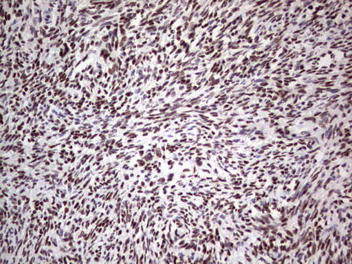 C14orf166 Antibody - IHC of paraffin-embedded Human Ovary tissue using anti-C14orf166 mouse monoclonal antibody. (Heat-induced epitope retrieval by 1 mM EDTA in 10mM Tris, pH8.5, 120°C for 3min).