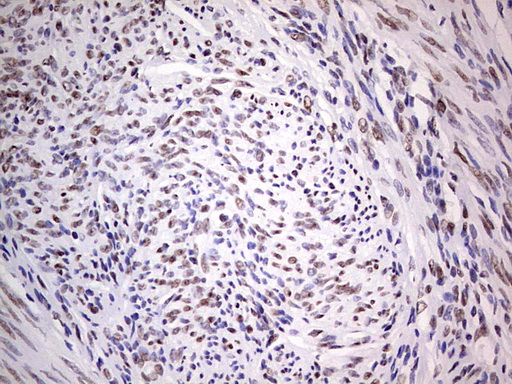 C14orf166 Antibody - IHC of paraffin-embedded Human endometrium tissue using anti-C14orf166 mouse monoclonal antibody. (Heat-induced epitope retrieval by 1 mM EDTA in 10mM Tris, pH8.5, 120°C for 3min).
