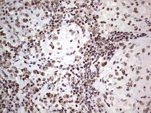 C14orf166 Antibody - IHC of paraffin-embedded Human lymph node tissue using anti-C14orf166 mouse monoclonal antibody. (Heat-induced epitope retrieval by 1 mM EDTA in 10mM Tris, pH8.5, 120°C for 3min).