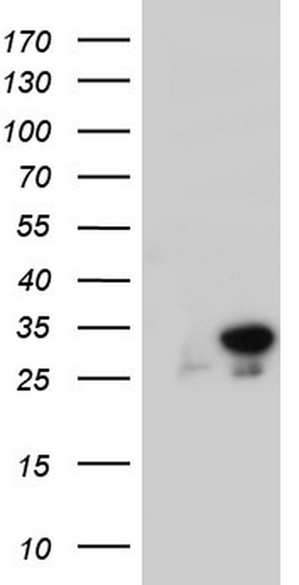 C14orf166 Antibody - HEK293T cells were transfected with the pCMV6-ENTRY control (Left lane) or pCMV6-ENTRY C14orf166 (Right lane) cDNA for 48 hrs and lysed. Equivalent amounts of cell lysates (5 ug per lane) were separated by SDS-PAGE and immunoblotted with anti-C14orf166.