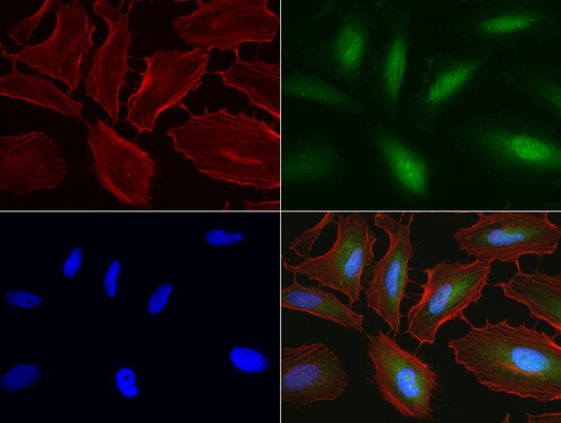 C14orf166 Antibody - Immunofluorescent staining of HeLa cells using anti-C14orf166 mouse monoclonal antibody  green, 1:100). Actin filaments were labeled with Alexa Fluor® 594 Phalloidin. (red), and nuclear with DAPI. (blue).