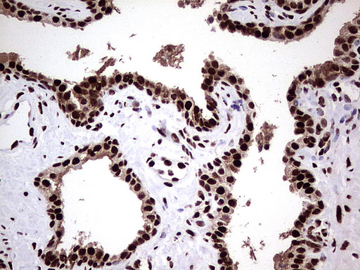 C14orf166 Antibody - Immunohistochemical staining of paraffin-embedded Human prostate tissue using anti-C14orf166 mouse monoclonal antibody.  heat-induced epitope retrieval by 1 mM EDTA in 10mM Tris, pH8.5, 120C for 3min)