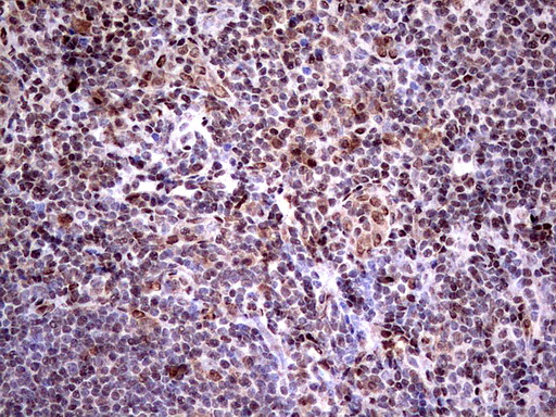 C14orf166 Antibody - Immunohistochemical staining of paraffin-embedded Human tonsil using anti-C14orf166 mouse monoclonal antibody.  heat-induced epitope retrieval by 1 mM EDTA in 10mM Tris, pH8.5, 120C for 3min)