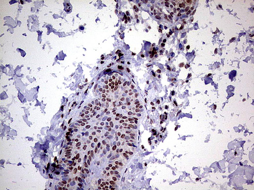 C14orf166 Antibody - Immunohistochemical staining of paraffin-embedded Human skin tissue using anti-C14orf166 mouse monoclonal antibody.  heat-induced epitope retrieval by 1 mM EDTA in 10mM Tris, pH8.5, 120C for 3min)