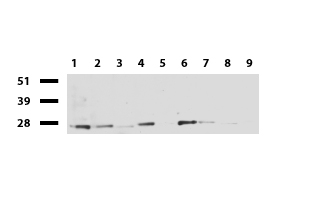 C14orf166 Antibody - Western blot of cell lysates. (35ug) from 9 different cell lines. (1: HepG2, 2: HeLa, 3: SV-T2, 4: A549, 5: COS7, 6: Jurkat, 7: MDCK, 8: PC-12, 9: MCF7). Diluation: 1:250