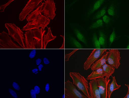 C14orf166 Antibody - Immunofluorescent staining of HeLa cells using anti-C14orf166 mouse monoclonal antibody  green, 1:50). Actin filaments were labeled with Alexa Fluor® 594 Phalloidin. (red), and nuclear with DAPI. (blue).