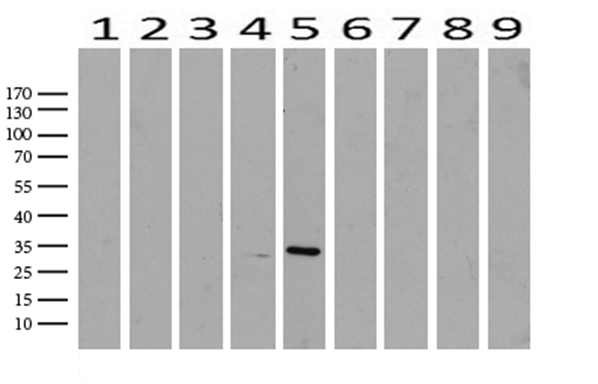 C14orf166 Antibody - Western blot analysis of extracts. (15ug) from 9 Human tissue by using anti-C14orf166 monoclonal antibody. (1: Testis; 2: Uterus; 3: Breast; 4: Brain; 5: Liver; 6: Ovary; 7: Thyroid gland; 8: colon:;9:Spleen). (1:500) Dilution: 1:500