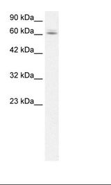 C14orf169 / NO66 Antibody - HepG2 Cell Lysate.  This image was taken for the unconjugated form of this product. Other forms have not been tested.