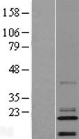 C14orf180 Protein - Western validation with an anti-DDK antibody * L: Control HEK293 lysate R: Over-expression lysate