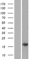 C14orf181 Protein - Western validation with an anti-DDK antibody * L: Control HEK293 lysate R: Over-expression lysate