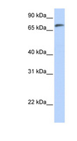 C14orf37 Antibody - C14orf37 antibody Western blot of Fetal Lung lysate. This image was taken for the unconjugated form of this product. Other forms have not been tested.