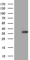 C14orf80 Antibody - HEK293T cells were transfected with the pCMV6-ENTRY control. (Left lane) or pCMV6-ENTRY C14orf80. (Right lane) cDNA for 48 hrs and lysed. Equivalent amounts of cell lysates. (5 ug per lane) were separated by SDS-PAGE and immunoblotted with anti-C14orf80. (1:2000)