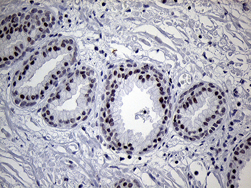 C14orf80 Antibody - Immunohistochemical staining of paraffin-embedded Human prostate tissue within the normal limits using anti-C14orf80 mouse monoclonal antibody. (Heat-induced epitope retrieval by 1mM EDTA in 10mM Tris buffer. (pH8.5) at 120°C for 3 min. (1:250)