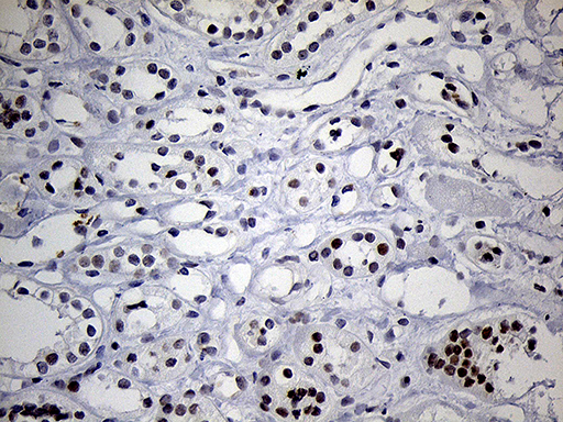 C14orf80 Antibody - Immunohistochemical staining of paraffin-embedded Human Kidney tissue within the normal limits using anti-C14orf80 mouse monoclonal antibody. (Heat-induced epitope retrieval by 1mM EDTA in 10mM Tris buffer. (pH8.5) at 120°C for 3 min. (1:250)