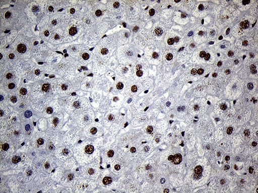 C14orf80 Antibody - Immunohistochemical staining of paraffin-embedded Human liver tissue within the normal limits using anti-C14orf80 mouse monoclonal antibody. (Heat-induced epitope retrieval by 1mM EDTA in 10mM Tris buffer. (pH8.5) at 120°C for 3 min. (1:250)