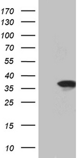 C14orf80 Antibody - HEK293T cells were transfected with the pCMV6-ENTRY control. (Left lane) or pCMV6-ENTRY C14orf80. (Right lane) cDNA for 48 hrs and lysed. Equivalent amounts of cell lysates. (5 ug per lane) were separated by SDS-PAGE and immunoblotted with anti-C14orf80. (1:2000)