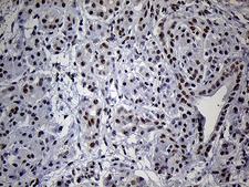 C14orf80 Antibody - Immunohistochemical staining of paraffin-embedded Human pancreas tissue within the normal limits using anti-C14orf80 mouse monoclonal antibody. (Heat-induced epitope retrieval by 1mM EDTA in 10mM Tris buffer. (pH8.5) at 120°C for 3 min. (1:250)