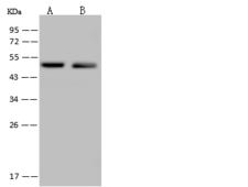 C14orf80 Antibody - Anti-C14orf80 rabbit polyclonal antibody at 1:500 dilution. Lane A: Jurkat Whole Cell Lysate. Lane B: U-251 MG Whole Cell Lysate. Lysates/proteins at 30 ug per lane. Secondary: Goat Anti-Rabbit IgG (H+L)/HRP at 1/10000 dilution. Developed using the ECL technique. Performed under reducing conditions. Predicted band size: 54 kDa. Observed band size: 54 kDa.