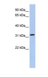 C15orf26 Antibody - 721_B cell lysate. Antibody concentration: 1.0 ug/ml. Gel concentration: 12%.  This image was taken for the unconjugated form of this product. Other forms have not been tested.