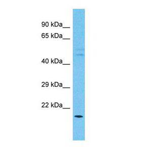 C15orf26 Antibody - Western blot of Human Esophagus Tumor. C15orf26 antibody dilution 1.0 ug/ml.  This image was taken for the unconjugated form of this product. Other forms have not been tested.