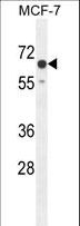 C15orf27 Antibody - CO027 Antibody western blot of MCF-7 cell line lysates (35 ug/lane). The CO027 antibody detected the CO027 protein (arrow).