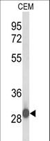 C15orf29 Antibody - Western blot of C15orf29 Antibody in CEM cell line lysates (35 ug/lane). C15orf29 (arrow) was detected using the purified antibody.