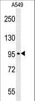 C15orf39 Antibody - CO039 Antibody western blot of A549 cell line lysates (35 ug/lane). The CO039 antibody detected the CO039 protein (arrow).