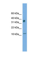 C15orf40 Antibody - C15orf40 antibody Western blot of Transfected 293T cell lysate. This image was taken for the unconjugated form of this product. Other forms have not been tested.