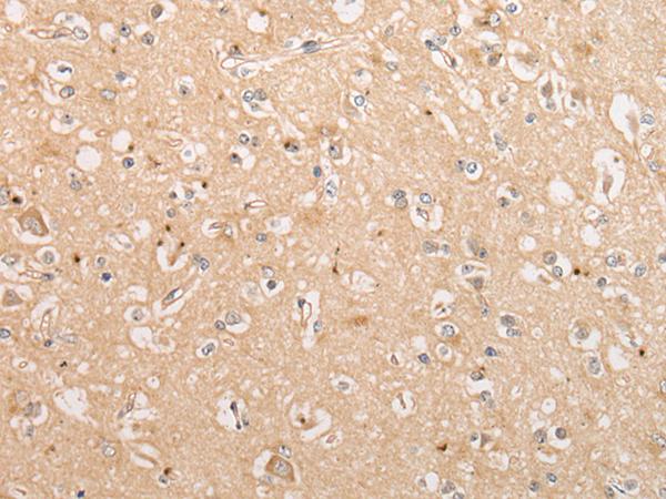 C15orf40 Antibody - Immunohistochemistry of paraffin-embedded Human brain tissue  using C15orf40 Polyclonal Antibody at dilution of 1:30(×200)