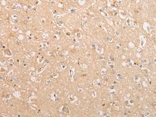 C15orf40 Antibody - Immunohistochemistry of paraffin-embedded Human brain tissue  using C15orf40 Polyclonal Antibody at dilution of 1:30(×200)