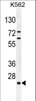 C15orf41 Antibody - C15orf41 Antibody western blot of K562 cell line lysates (35 ug/lane). The C15orf41 antibody detected the C15orf41 protein (arrow).