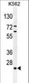 C15orf41 Antibody - C15orf41 Antibody western blot of K562 cell line lysates (35 ug/lane). The C15orf41 antibody detected the C15orf41 protein (arrow).
