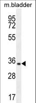 C15orf41 Antibody - C15orf41 Antibody western blot of mouse bladder tissue lysates (35 ug/lane). The C15orf41 antibody detected the C15orf41 protein (arrow).