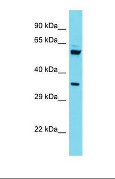 C15orf41 Antibody - Western blot of Human HepG2. C15orf41 antibody dilution 1.0 ug/ml.  This image was taken for the unconjugated form of this product. Other forms have not been tested.