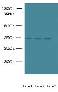 C15orf41 Antibody - Western blot. All lanes: C15orf41 antibody at 1.5 ug/ml. Lane 1: K562 whole cell lysate. Lane 2: HepG-2 whole cell lysate. Lane 3: U251 whole cell lysate. Secondary antibody: Goat polyclonal to Rabbit IgG at 1:10000 dilution. Predicted band size: 32 kDa. Observed band size: 32 kDa.