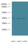 C15orf41 Antibody - Western blot. All lanes: C15orf41 antibody at 1.5 ug/ml. Lane 1: K562 whole cell lysate. Lane 2: HepG-2 whole cell lysate. Lane 3: U251 whole cell lysate. Secondary antibody: Goat polyclonal to Rabbit IgG at 1:10000 dilution. Predicted band size: 32 kDa. Observed band size: 32 kDa.