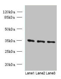 C15orf41 Antibody - Western blot All lanes: C15orf41 antibody at 1.5µg/ml Lane 1: K562 whole cell lysate Lane 2: HepG2 whole cell lysate Lane 3: U251 whole cell lysate Secondary Goat polyclonal to rabbit IgG at 1/10000 dilution Predicted band size: 33, 22 kDa Observed band size: 33 kDa