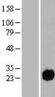 C15orf57 / CCDC32 Protein - Western validation with an anti-DDK antibody * L: Control HEK293 lysate R: Over-expression lysate