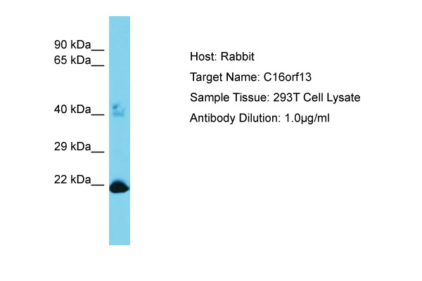 C16orf13 Antibody -  This image was taken for the unconjugated form of this product. Other forms have not been tested.