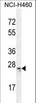 C16orf45 Antibody - CP045 Antibody western blot of NCI-H460 cell line lysates (35 ug/lane). The CP045 antibody detected the CP045 protein (arrow).