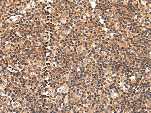 C16orf45 Antibody - Immunohistochemistry of paraffin-embedded Human tonsil tissue  using C16orf45 Polyclonal Antibody at dilution of 1:45(×200)