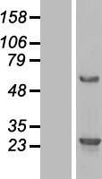 C16orf45 Protein - Western validation with an anti-DDK antibody * L: Control HEK293 lysate R: Over-expression lysate