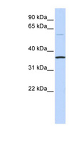 C16orf46 Antibody - C16orf46 antibody Western blot of Fetal Brain lysate. This image was taken for the unconjugated form of this product. Other forms have not been tested.