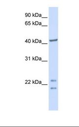 C16orf48 Antibody - Fetal brain lysate. Antibody concentration: 1.0 ug/ml. Gel concentration: 12%.  This image was taken for the unconjugated form of this product. Other forms have not been tested.