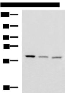 C16orf48 Antibody - Western blot analysis of Human cerebrum tissue Human cerebella tissue Mouse brain tissue lysates  using ENKD1 Polyclonal Antibody at dilution of 1:1150