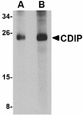 C16orf5 / I1 Antibody - Western blot of CDIP in human brain lysate with CDIP antibody at (A) 1 and (B) 2 ug/ml.