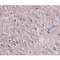 C16orf5 / I1 Antibody - Immunohistochemistry of FNIP2 in mouse brain tissue with FNIP2 antibody at 2.5 µg/mL.
