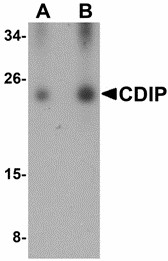 C16orf5 / I1 Antibody - Western blot of CDIP in human brain lysate with CDIP antibody at (A) 0.25 and (B) 0.5 ug/ml.